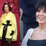 Kris Jenner Face lift