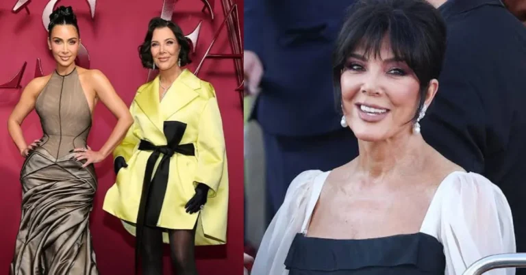 Kris Jenner Face lift