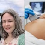 Ashleigh Rousseaux Stillbirth Ultrasound